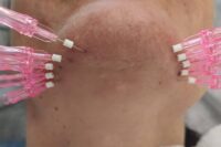 Medycyna estetyczna - Brodnica MŚ Studio