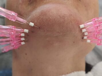 Medycyna estetyczna - Brodnica MŚ Studio