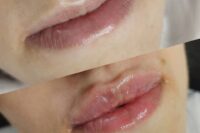 Zabiegi na ciało - Brodnica MŚ Studio