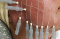 Zabiegi upiększające - Brodnica MŚ Studio